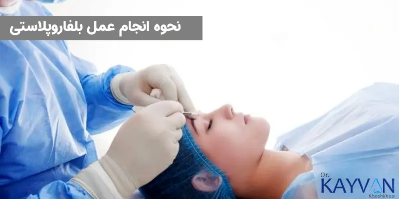 این جراحی هم بر روی پلک بالا و هم بر روی پلک پایین انجام خواهد شد در ابتدا داروی بیحسی به اطراف چشم تزریق شده و سپس برش هایی در امتداد خطوط طبیعی پلک ایجاد شده و پوست از بافت زیری آن جدا خواهد شد، پس از این کار پوست ها وچربی های اضافی و حتی در صورت لزوم عضله برداشته خواهد شد. در نهایت نیز برش ها توسط بهترین جراح بخیه زده خواهد شد. 