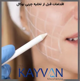 اقدامات قبل از تخلیه بوکال فت