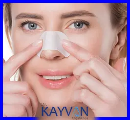 مراقبت-های-کلی-بعد-از-عمل-بینی
