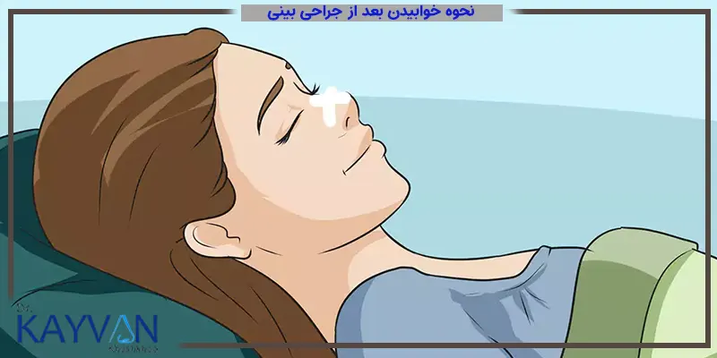 یکی از مراقبت های بعد از جراحی بینی که از اهمیت بالایی نیز برخوردار است، نحوه خوابیدن بعد از عمل است، که نکاتی برای آن توسط جراح بینی توصیه می شود. 