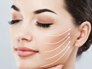 تخلیه چربی بوکال