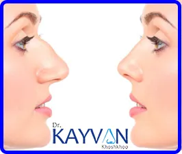 عمل-قوز-بینی