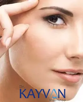 مراقبت-های-پس-از-جراحی-لیفت-ابرو-6