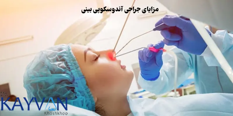 مزایای-جراحی-آندوسکوپی-بینی