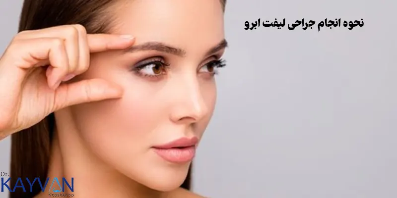 نحوه-انجام-جراحی-لیفت-ابرو