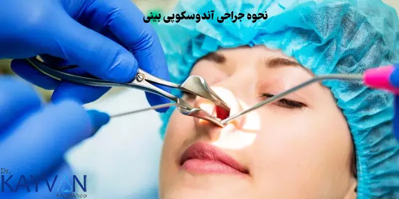 نحوه-جراحی-آندوسکوپی-بینی
