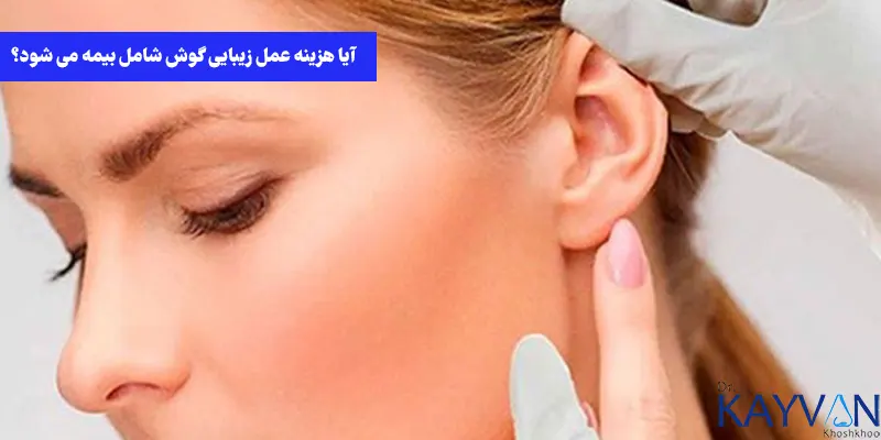 هزینه-عمل-زیبایی-گوش-با-بیمه