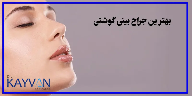 بهترین-جراح-بینی-گوشتی-و-ویژگی-های-آن