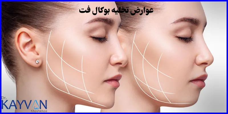 عوارض-جراحی-تخلیه-بوکال-فت