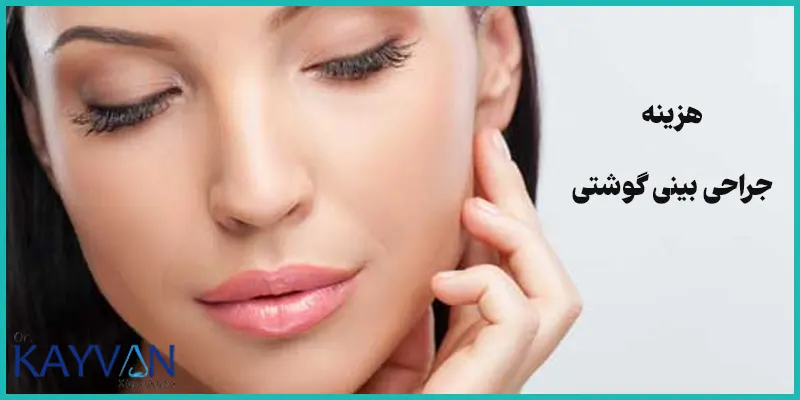هزینه-جراحی-بینی-گوشتی