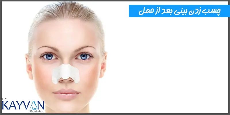 چسب-زدن-بینی-بعد-از-عمل