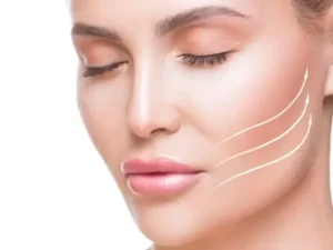 مراقبت های بعد از تخلیه بوکال فت