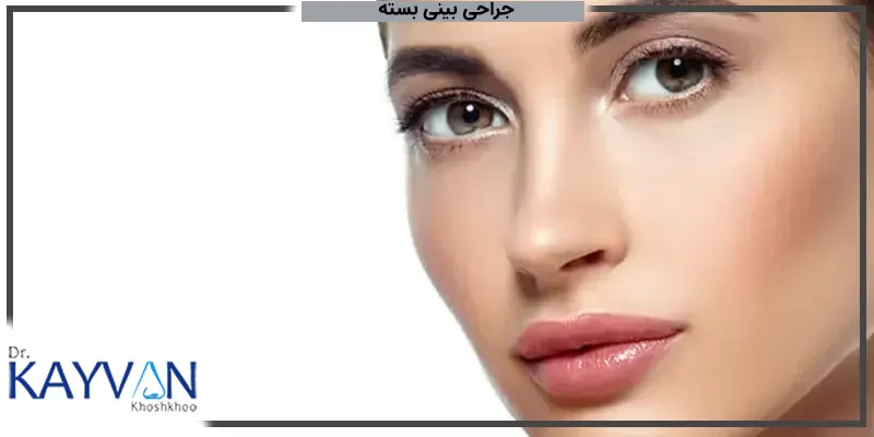 جراحی-بینی-بسته-با-دکتر-کیوان-خوشو