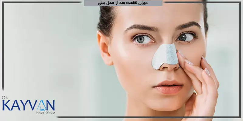 دوران-نقاهت-بعد-از-جراحی-بینی