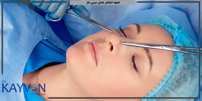 نحوه-انجام-عمل-بینی-باز