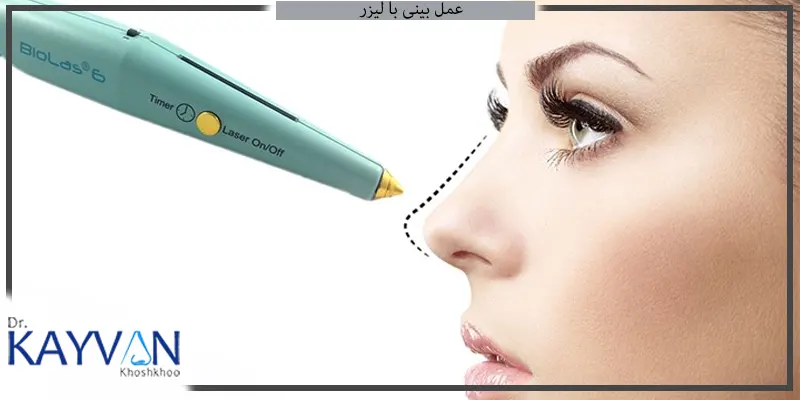 عمل-بینی-با-لیزر-چیست