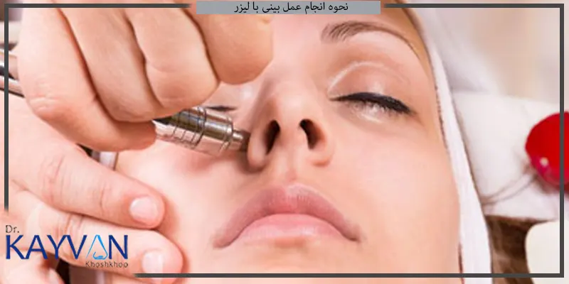 نحوه-انجام-عمل-بینی-با-لیزر