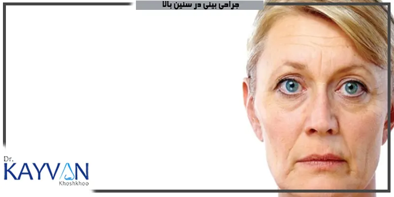 جراحی-بینی-در-سنین-بالا-می-توان-انجام-داد؟