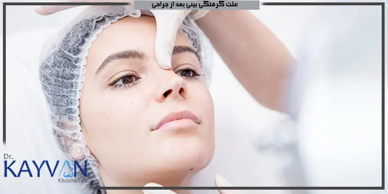 علت-گرفتگی-بینی-بعد-از-جراحی