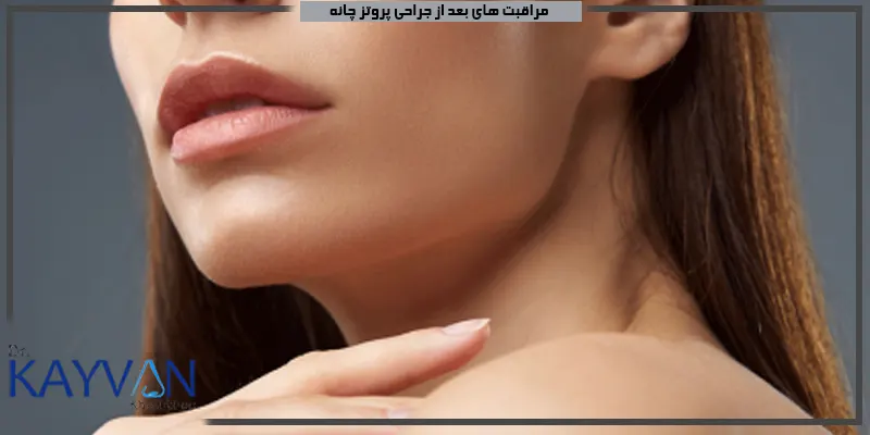 مراقبت-های-بعد-از-جراحی-پروتز-چانه-را-بدانید