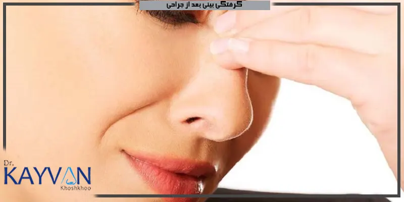 گرفتگی-بینی-بعد-از-جراحی-بینی
