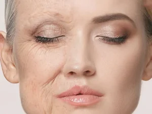جراحی بینی در سنین بالا