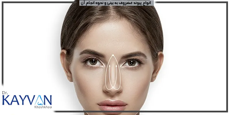 انواع-پیوند-غضروف-به-بینی-و-نحوه-انجام-آن