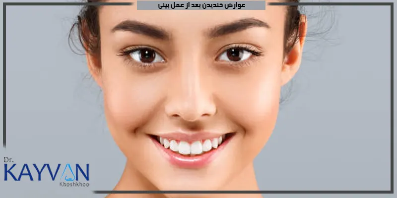 عوارض-خندیدن-بعد-از-عمل-بینی