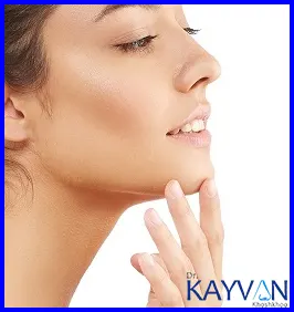 نحوه-درست-خندیدن-بعد-از-عمل-بینی