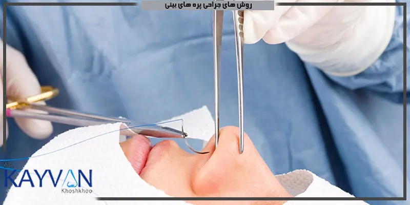 روش-های-جراحی-پره-های-بینی