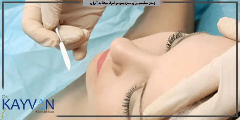 زمان-مناسب-برای-عمل-بینی-در-افراد-مبتلا-به-آلرژی