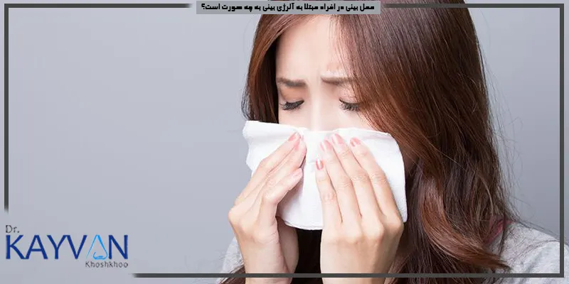 عمل-بینی-در-افراد-مبتلا-به-آلرژی-بینی-به-چه-صورت-است؟