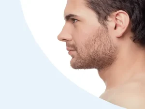عمل بینی طبیعی مردانه