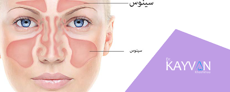 انواع جراحی سینوس بینی