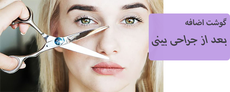 گوشت اضافه بعد از جراحی بینی
